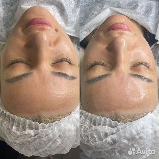 Услуги Косметолога