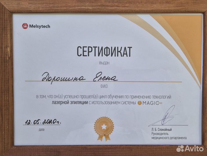 Лазерная эпиляция