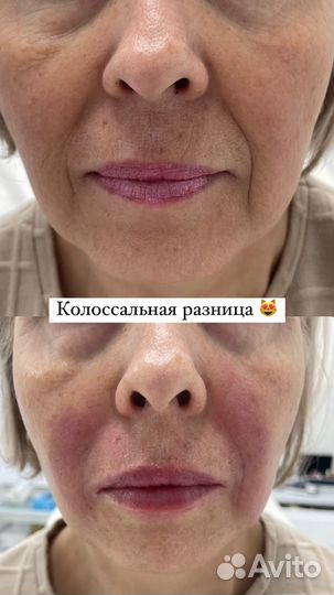 Косметология, лазерная эпиляция, трихопигментация