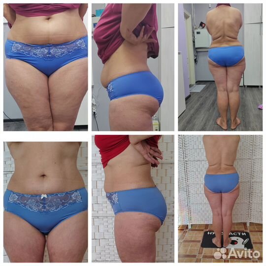 Аппаратный массаж