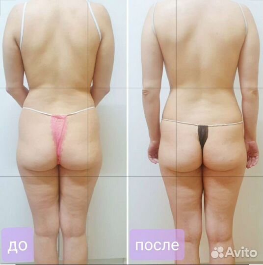 Оздоровительный массаж