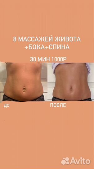 Массаж