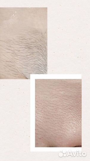 Шугаринг/восковая депиляция Петрозаводск