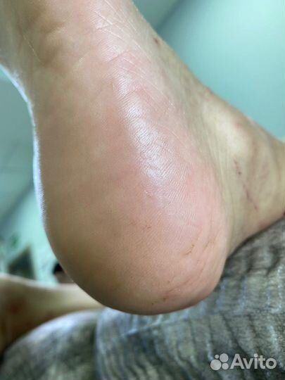 Маникюр, педикюр на дому