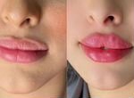 Моделирование губ, лица