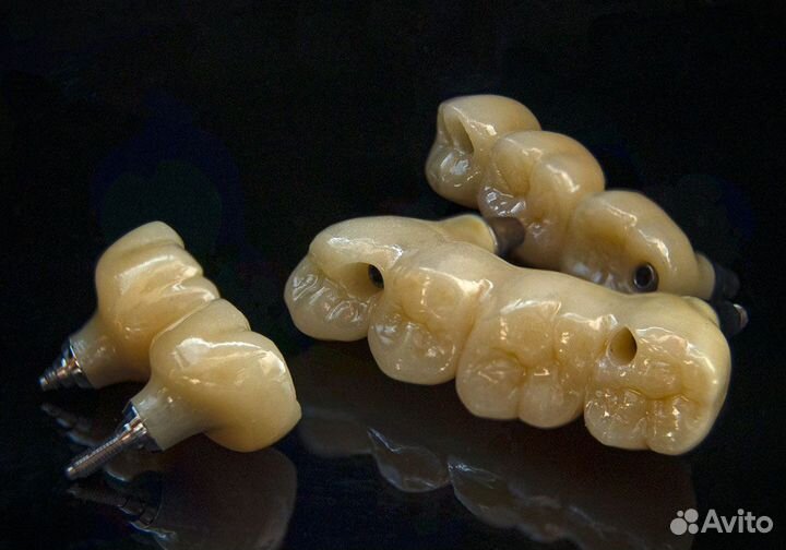 Все виды зуботехнических работ - четко и в срок