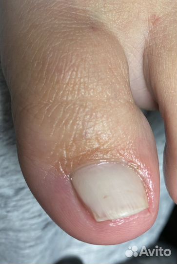 Подолог.Профессиональный педикюр. Срочный заказ