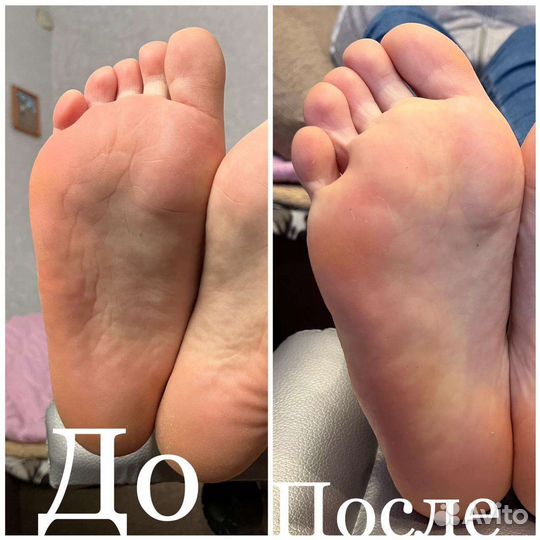 Педикюр на дому