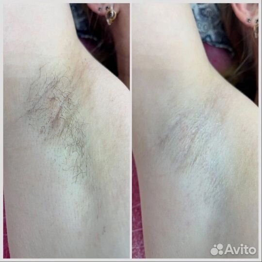 Депиляция/Брови