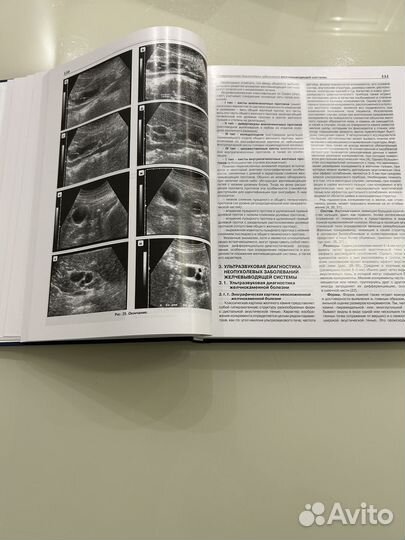 Практическое руководство по УЗ диагностике