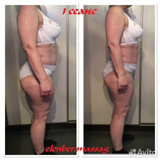 Классический массаж. Коррекция фигуры