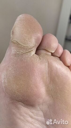 Маникюр, педикюр