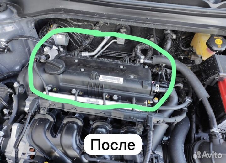 Крышка на двигатель kia rio 4