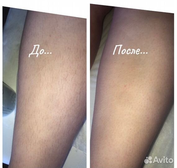 Восковая депиляция