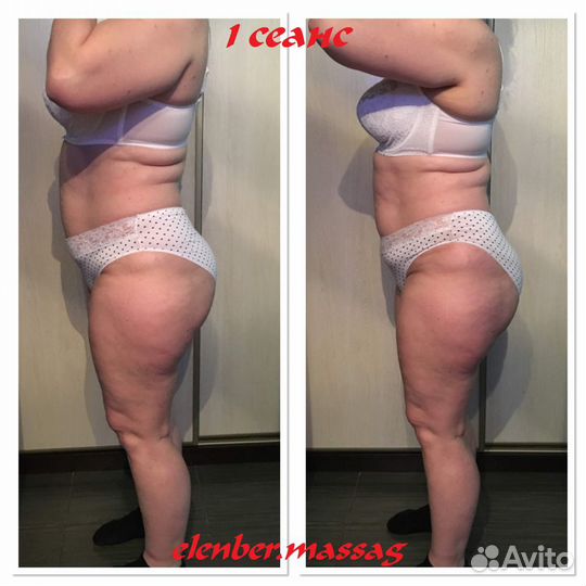 Классический массаж. Коррекция фигуры