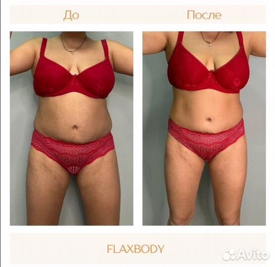 Аппаратная Коррекция фигуры