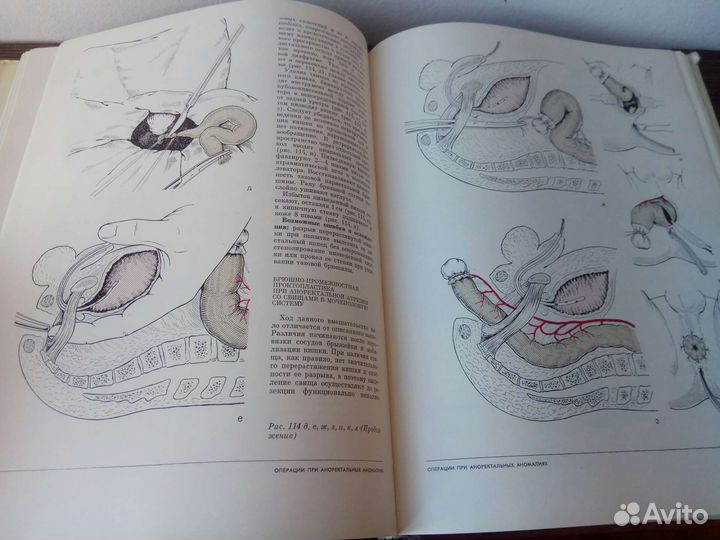 Атлас операций у новорожденных