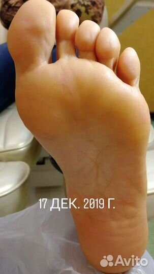 Услуги подолога