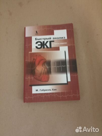 Быстрый анализ экг