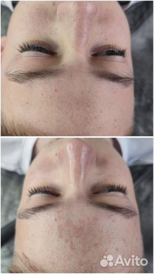 Косметолог эстетист