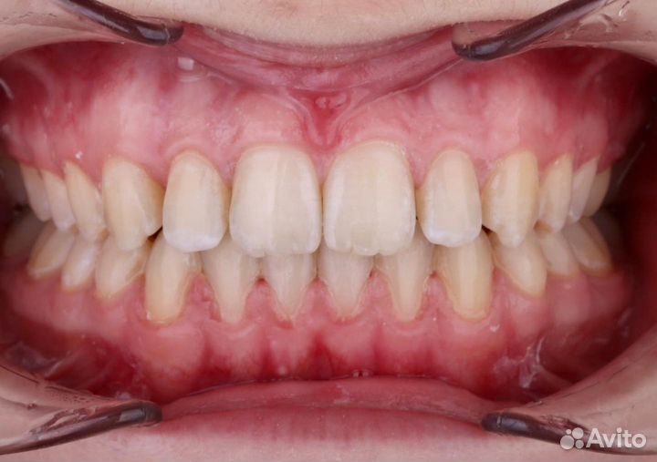 Canon 100mm 2.8 macro версия 1 отличный макро