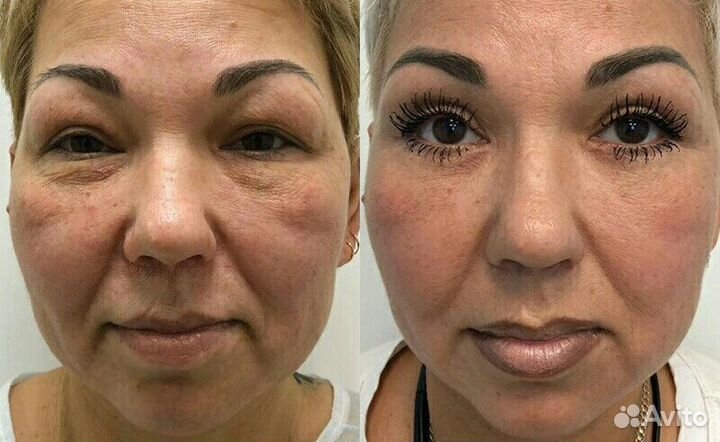 Программа стройное лицо И тело