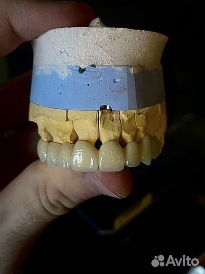 Зубной техник.Cad/cam.Зубные протезы