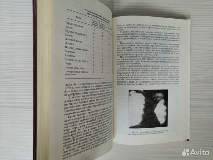 Лечение пораженных в грудь на госпитальном этапе