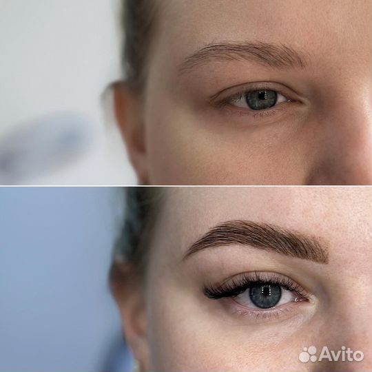 Брови, ресницы