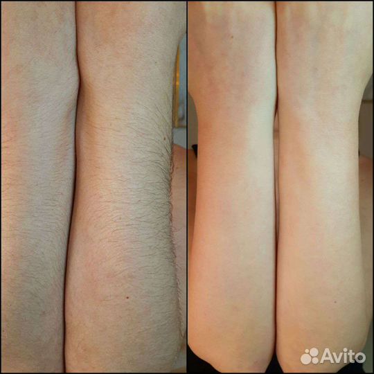 Шугаринг обучение