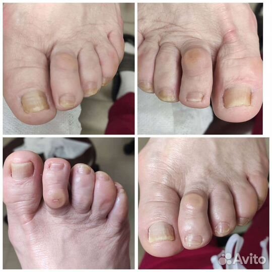 Подолог + мастер педикюра (лечебный и эстетический