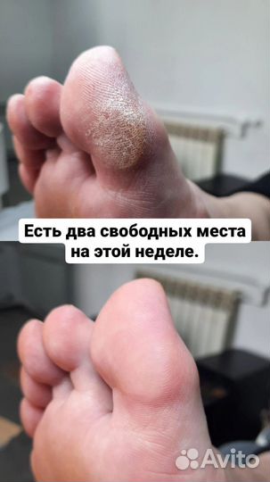 Педикюр/маникюр