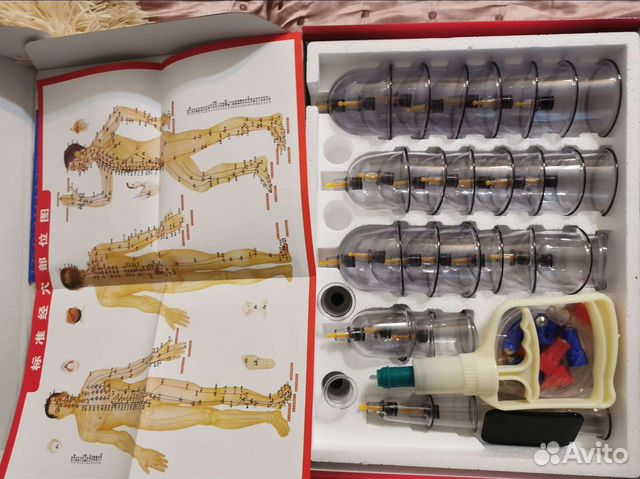 Банки для массажа, хамам, кровопускание