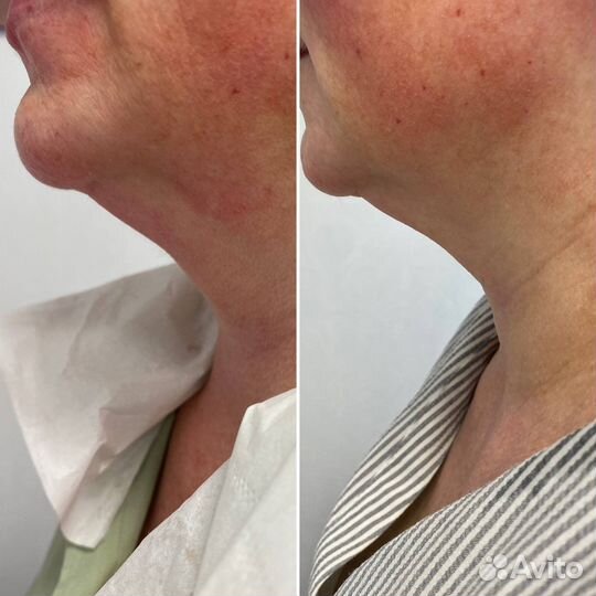 Косметолог. Эпиляция. Массаж лица