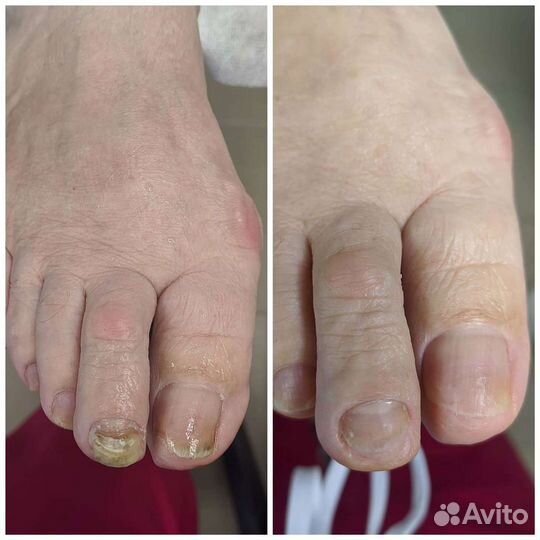 Подолог + мастер педикюра (лечебный и эстетический