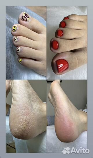 Титановая нить