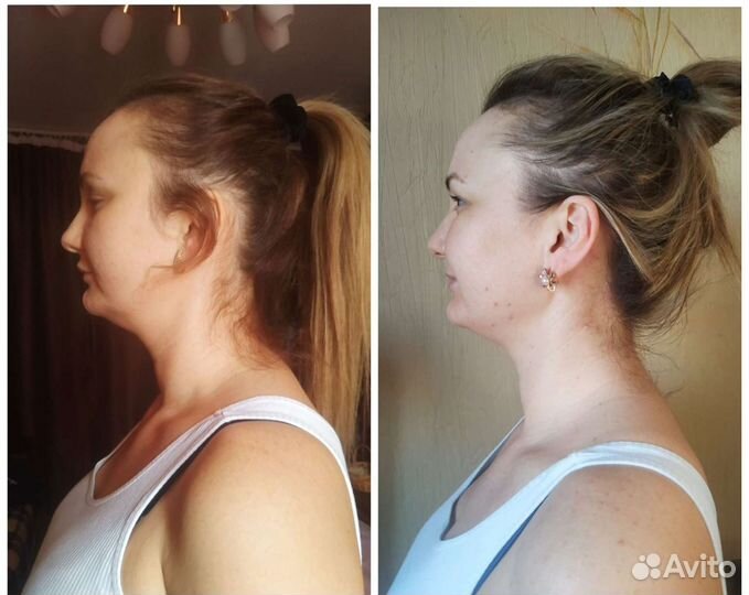 Скульптурно-буккальный массаж лица