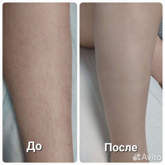 Восковая и сахарная депиляция