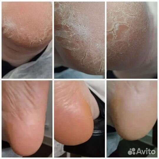 Подология ногтевой сервис