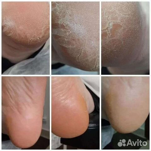 Подология ногтевой сервис