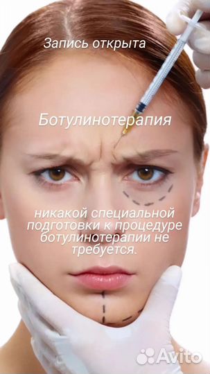 Ботокс для лица модель