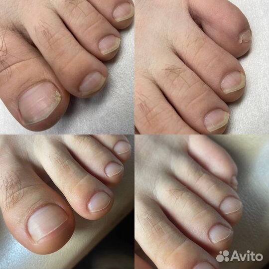 Подолог с выездом на дом