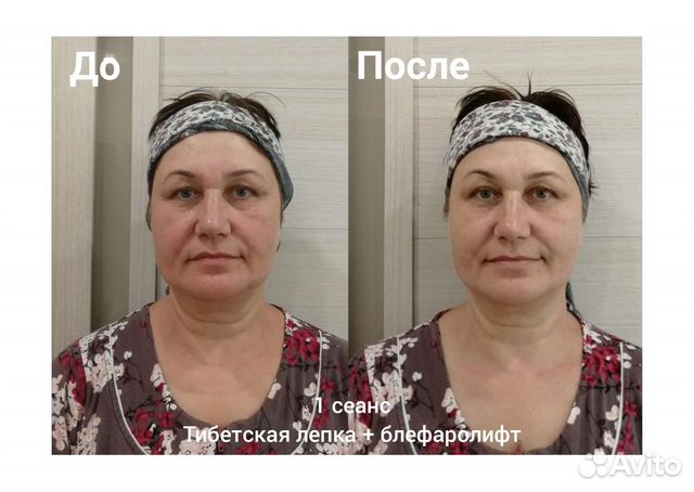 Массаж лица