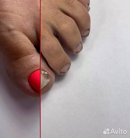 Маникюр. Педикюр