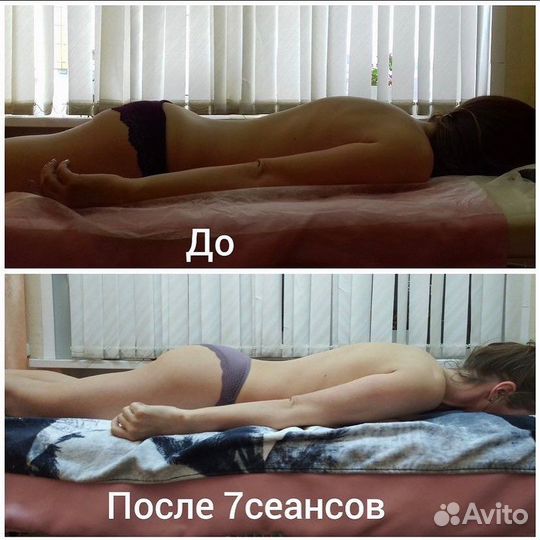 Ищем Модель - Спортивный массаж