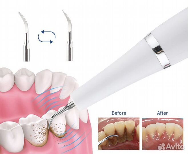 Скайлер стоматологический