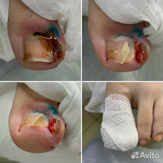 Подолог Маникюр Педикюр