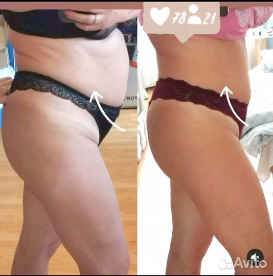 Антицеллюлитный массаж