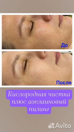 Услуги косметолога