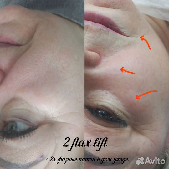 Услуги косметолога